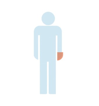 PROTECTOR IMPERMEABLE MANO 2